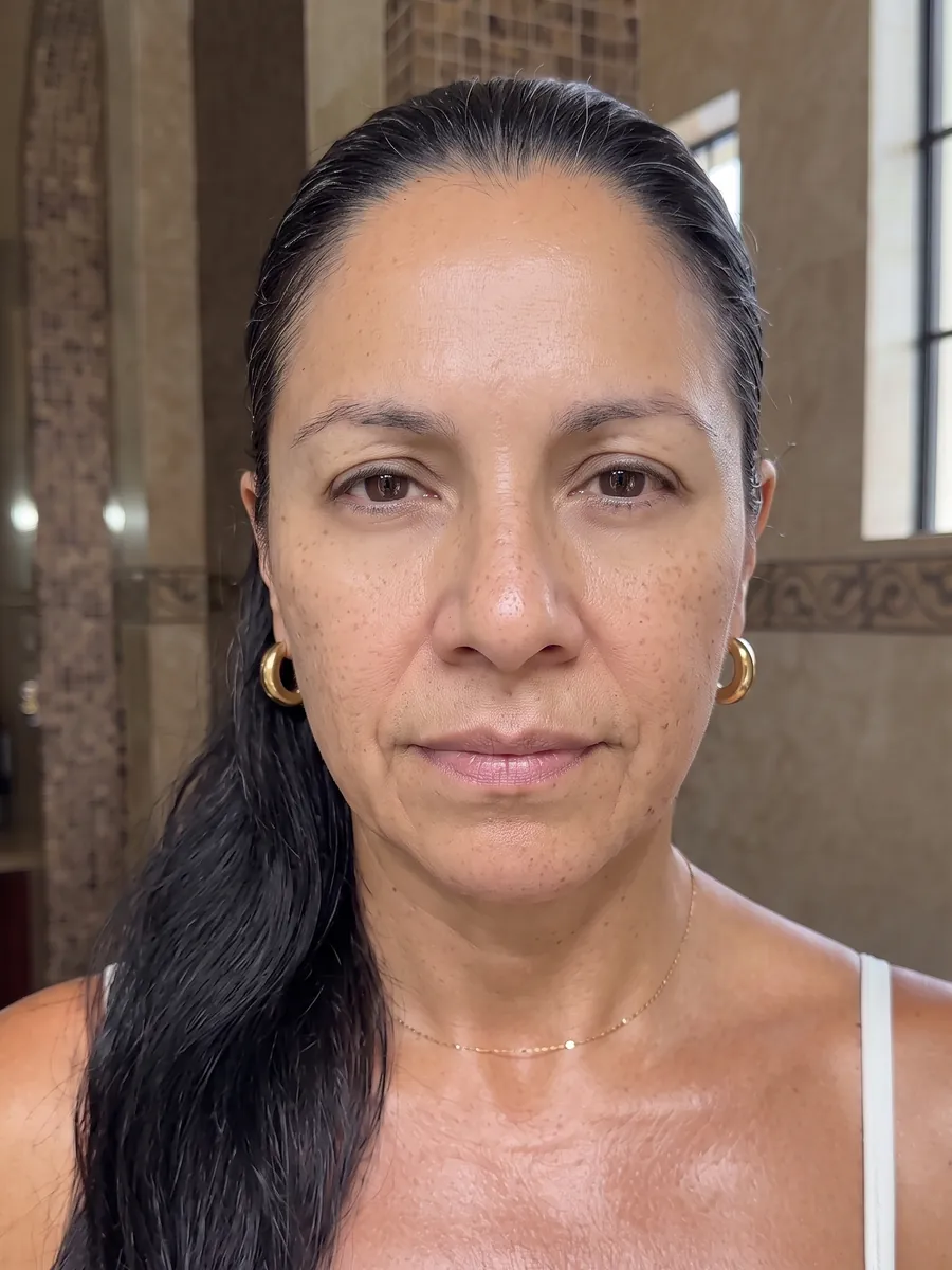 Marisol, botox, after, front