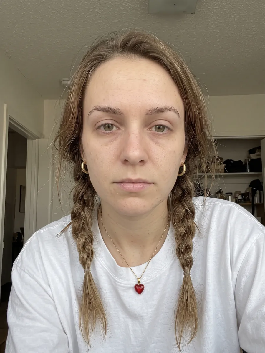 Paige, brow lift, after, front