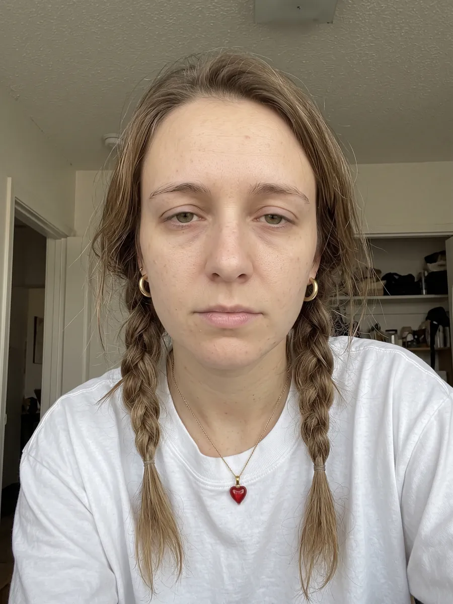 Paige, brow lift, before, front