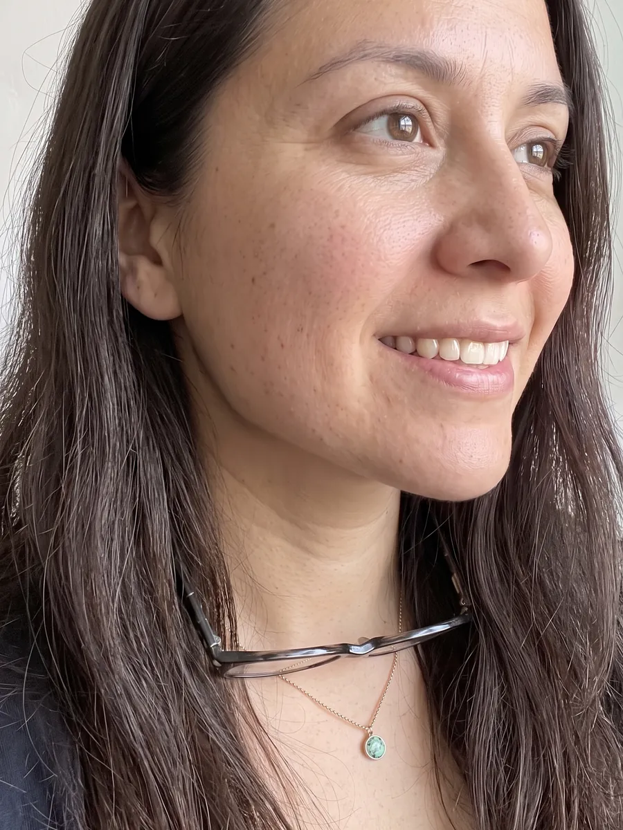 Alyssa, jawline contouring, after, 3/4