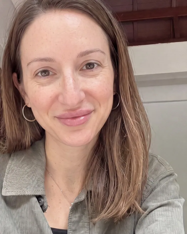 Cosmetic Preview · Lip augmentation