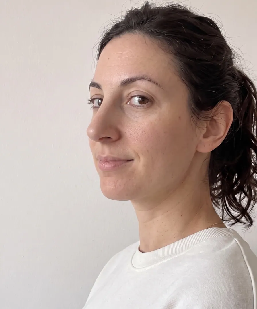 Aperçu esthétique · Rhinoplastie