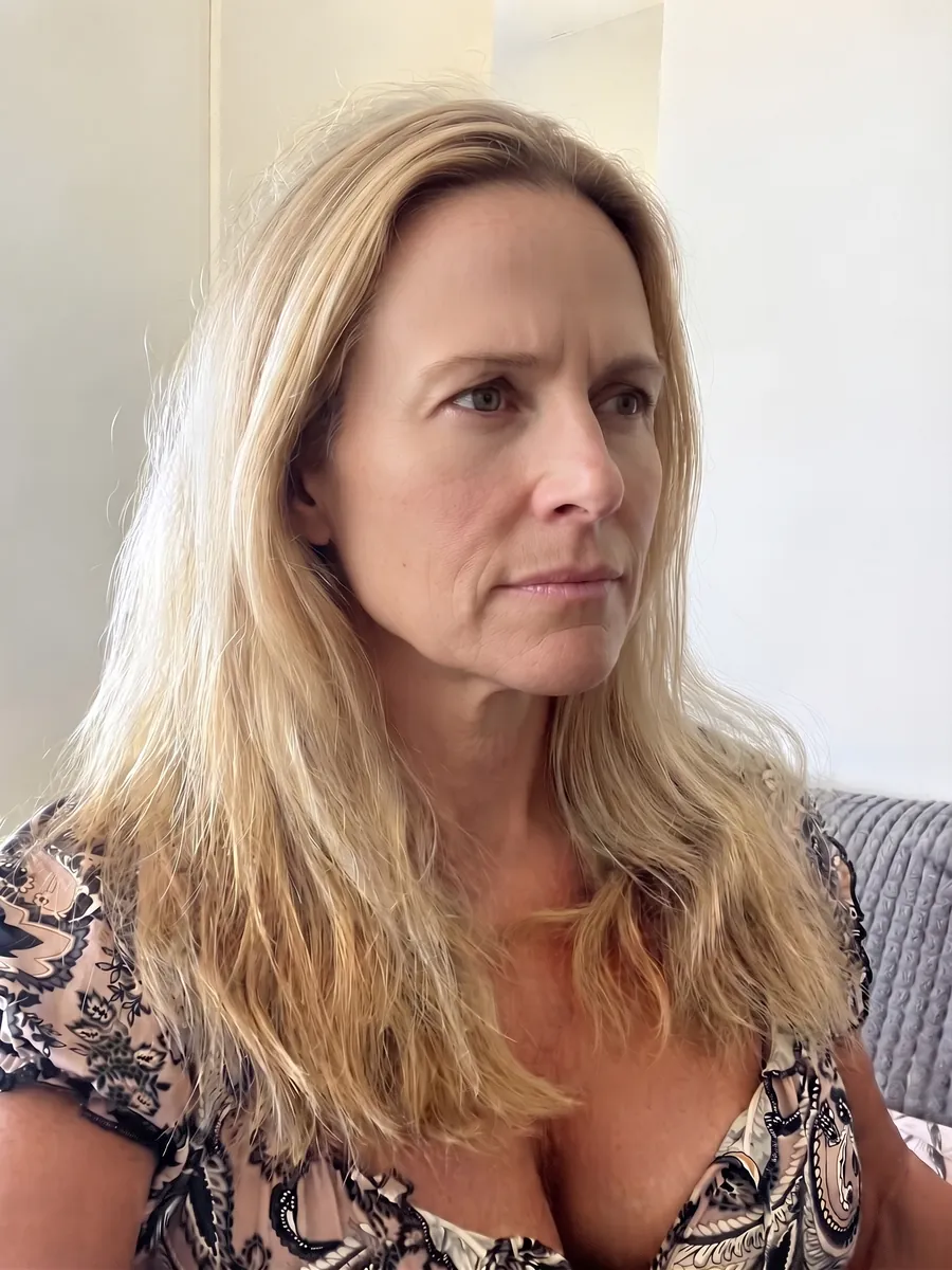 Susan, botox, full, front