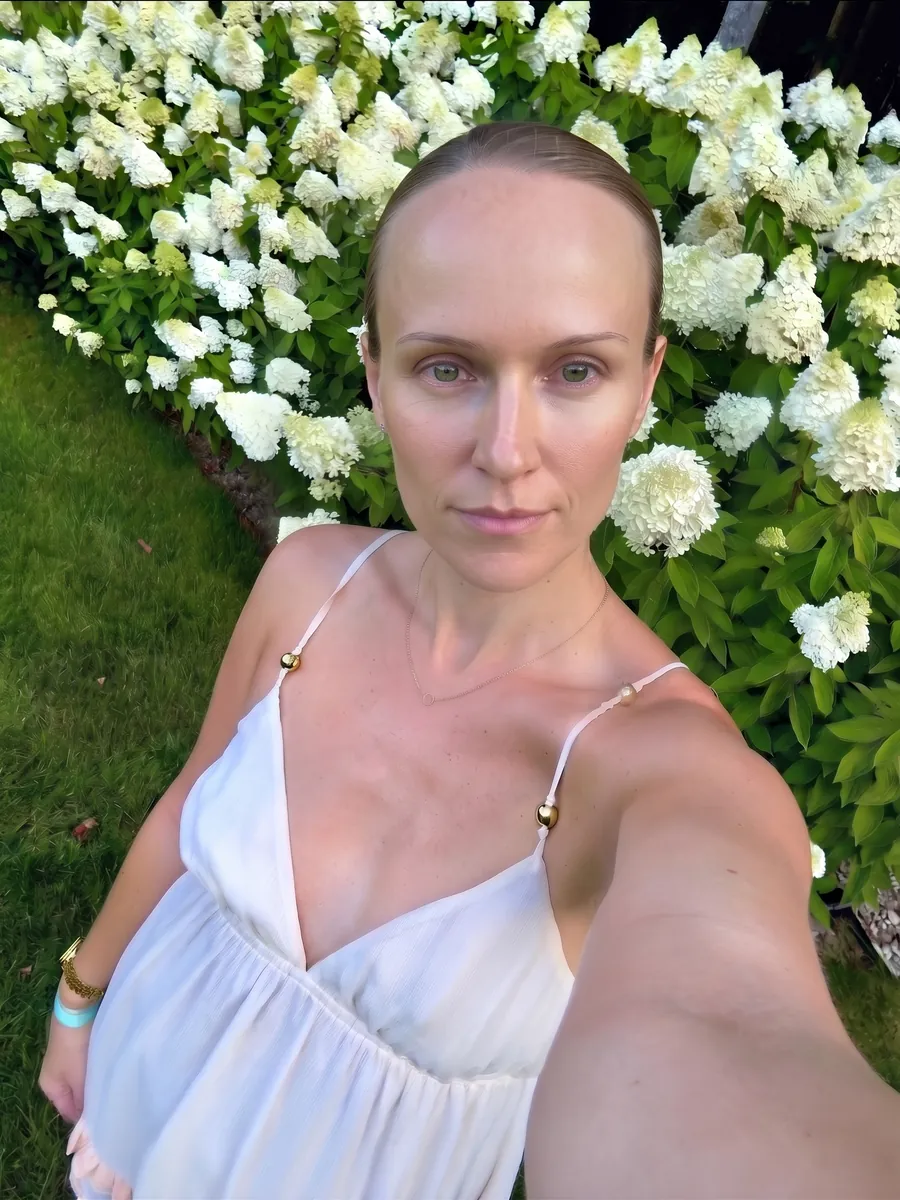 Brianna, forehead reduction, full, front
