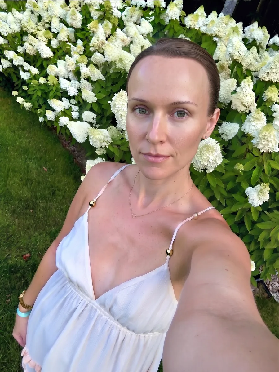 Brianna, forehead reduction, moderate, front
