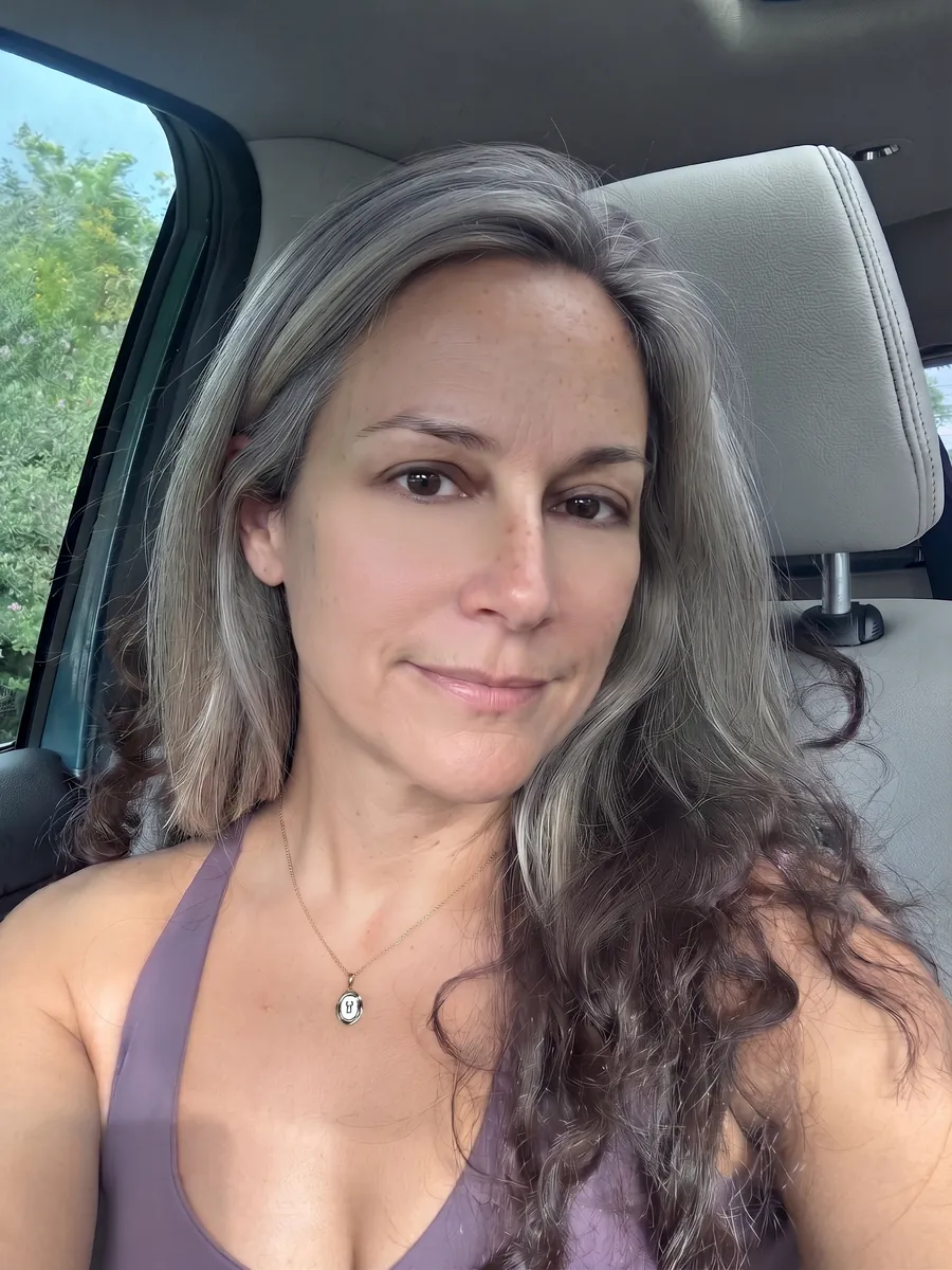 Diane, lower blepharoplasty, full, front