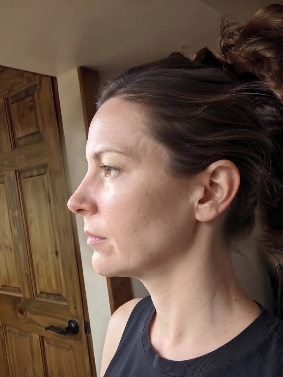 Naomi, lower jaw advancement, full, profile