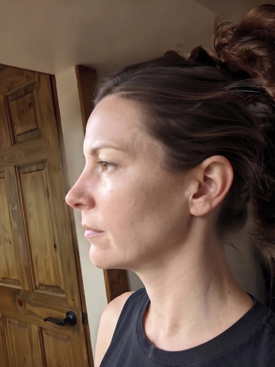 Naomi, lower jaw advancement, moderate, profile