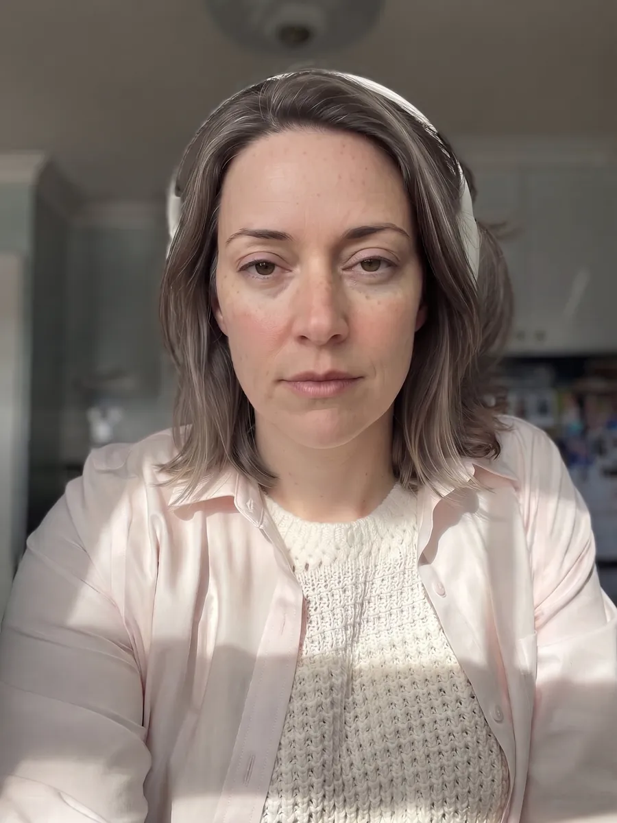 Claire, upper blepharoplasty, full, front