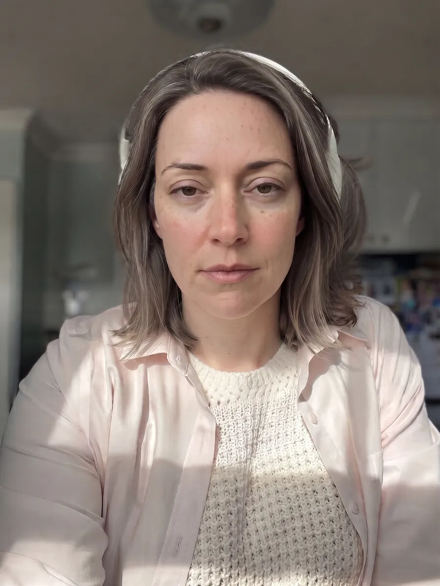 Claire, upper blepharoplasty, moderate, front