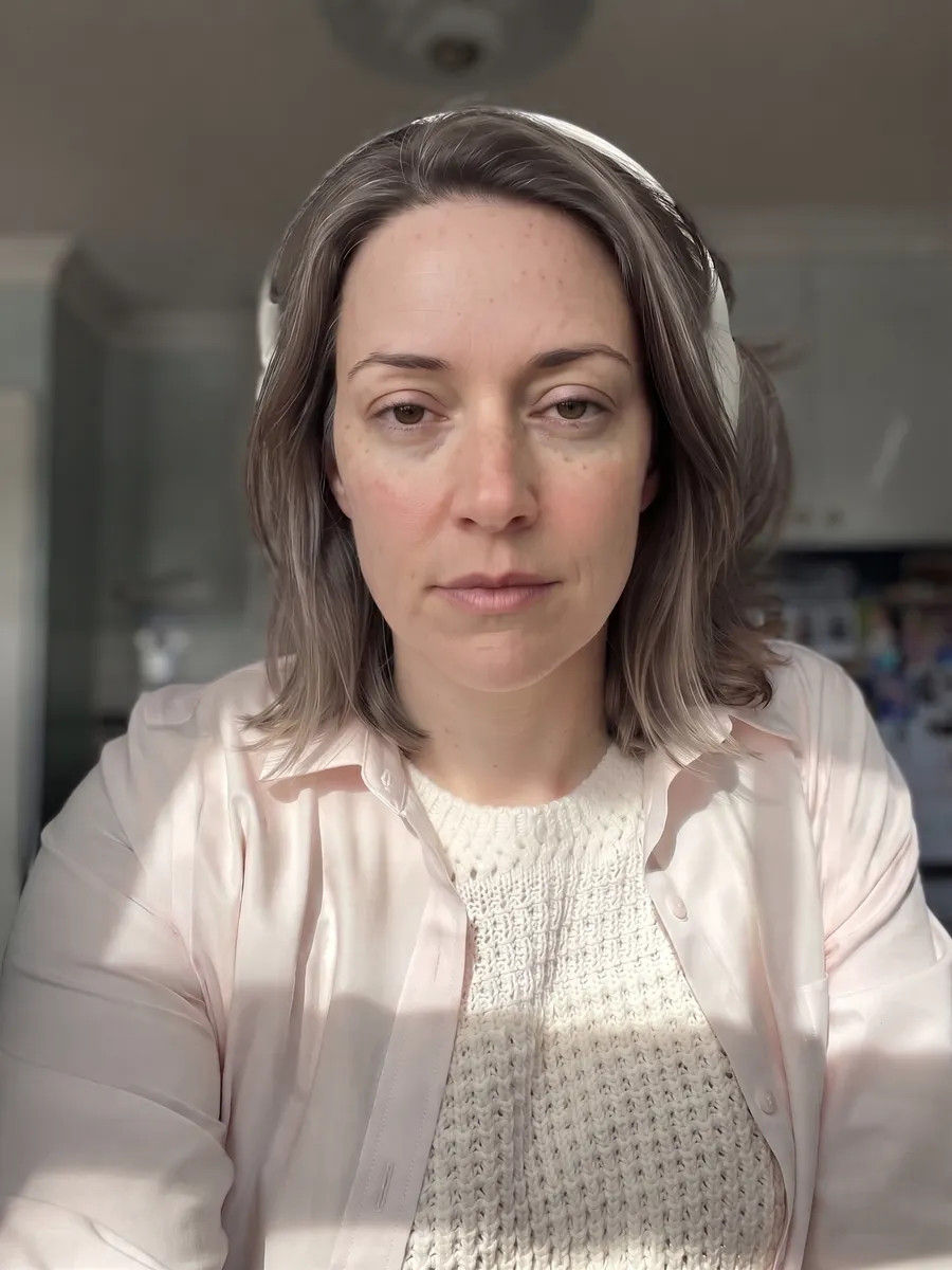 Claire, upper blepharoplasty, subtle, front